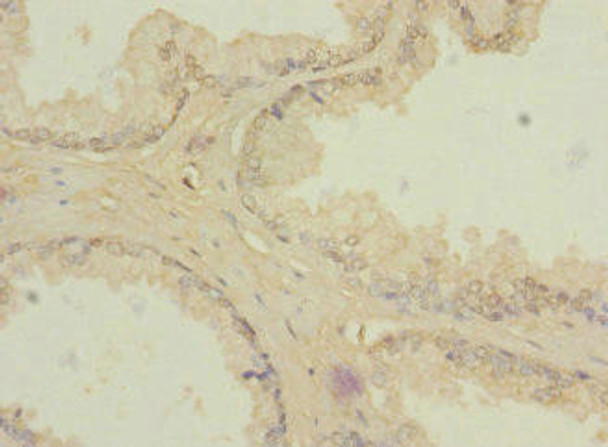 ZIC3 Antibody (PACO45306)