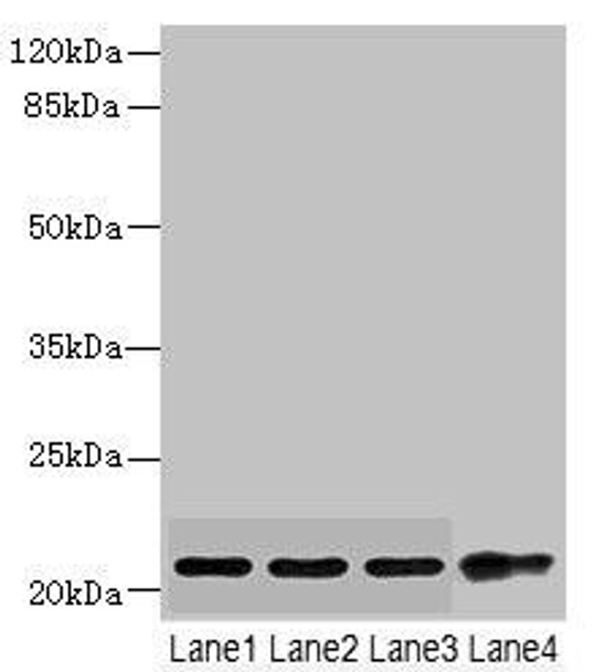 CSRP2 Antibody (PACO45500)