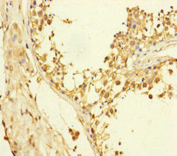 XPO6 Antibody (PACO45636)