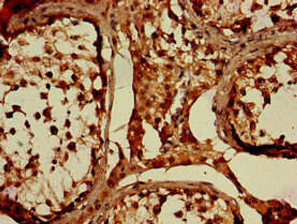 WNK1 Antibody (PACO51150)