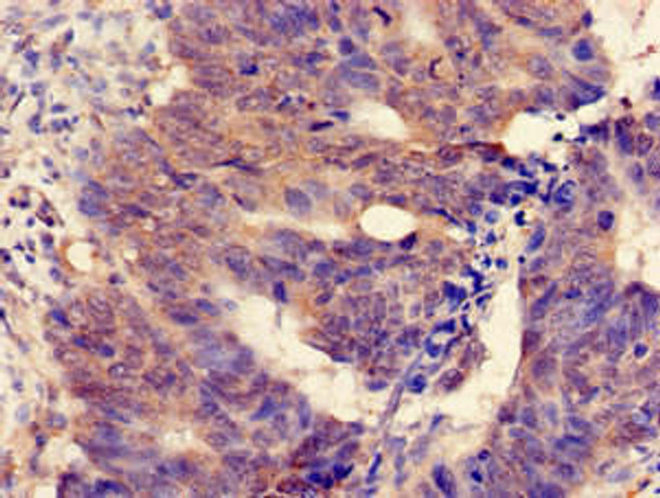 MGST2 Antibody (PACO51706)