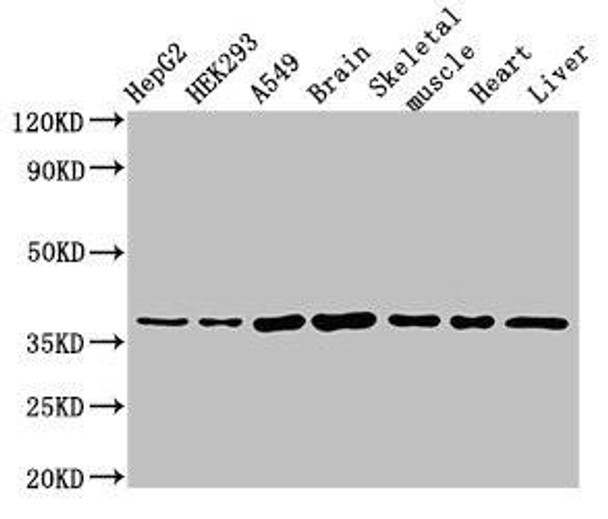 MYF6 Antibody (PACO51726)