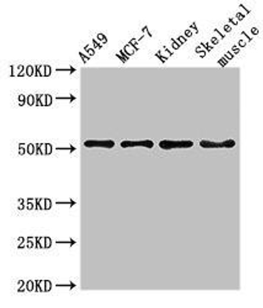 NARF Antibody (PACO51738)