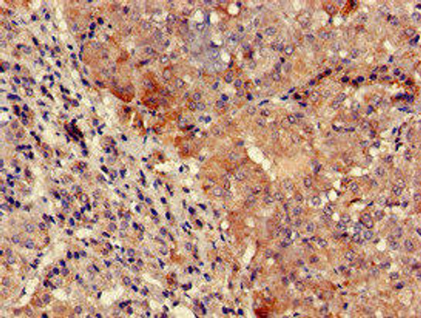 TYK2 Antibody (PACO52030)