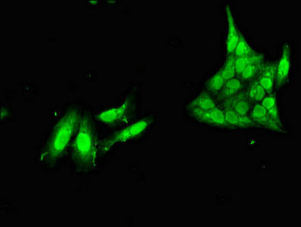 NANOS1 Antibody (PACO52598)