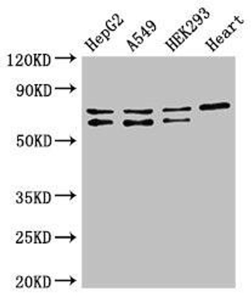 HIF3A Antibody (PACO52922)