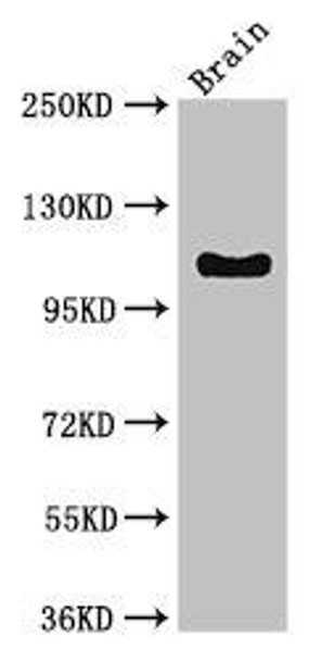 DSG3 Antibody (PACO52946)