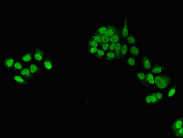 TXNL4A Antibody (PACO53054)