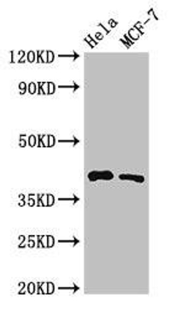 HLA-B Antibody (PACO54122)
