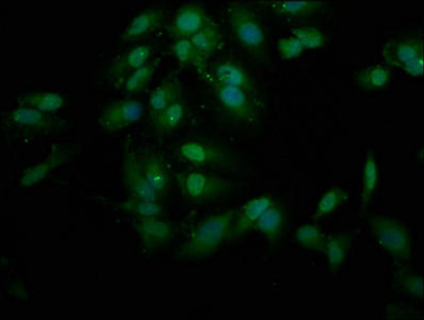 FANCL Antibody (PACO57528)