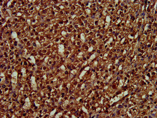 PPIE Antibody (PACO58592)