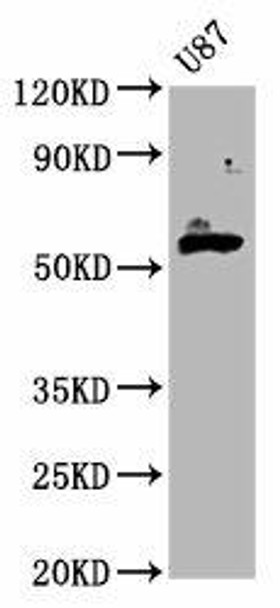 GPT2 Antibody (PACO59245)