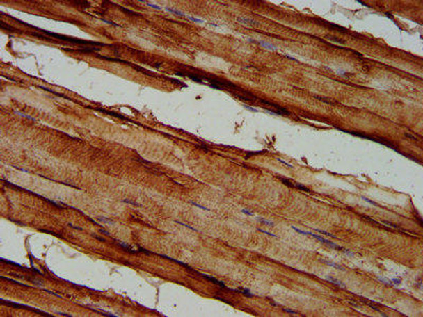 SEMA3C Antibody (PACO59365)