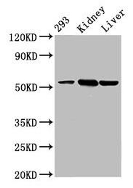 DBT Antibody (PACO60681)
