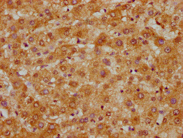 SLC1A7 Antibody (PACO60829)