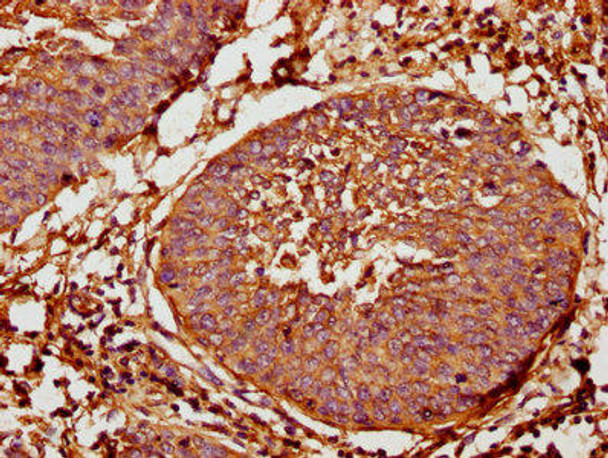 TAP2 Antibody (PACO60881)