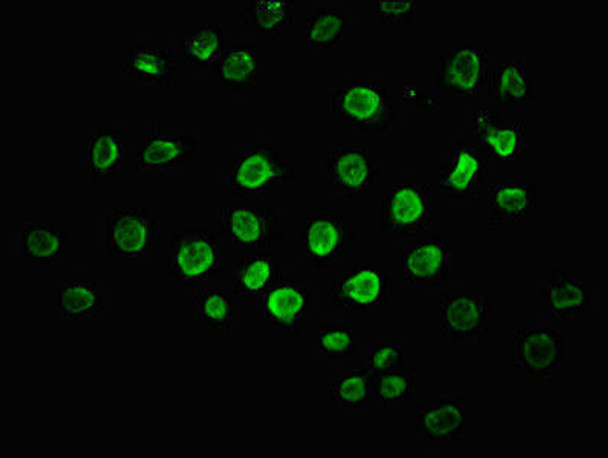 DUSP5 Antibody (PACO61378)