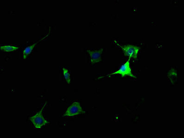 CHRM2 Antibody (PACO61915)