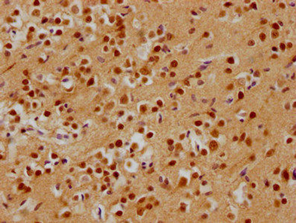 ADNP Antibody (PACO62831)