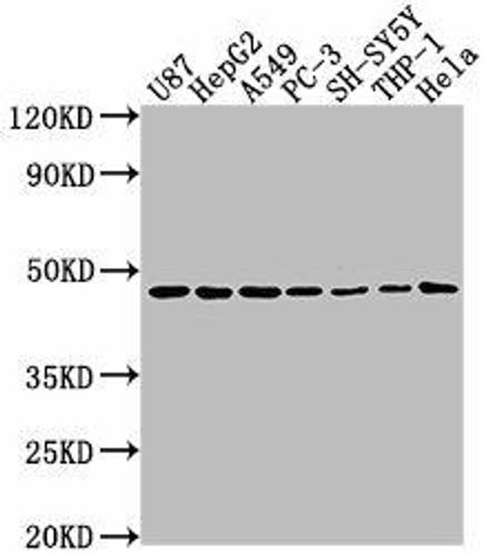 NDRG1 Antibody (PACO63451)