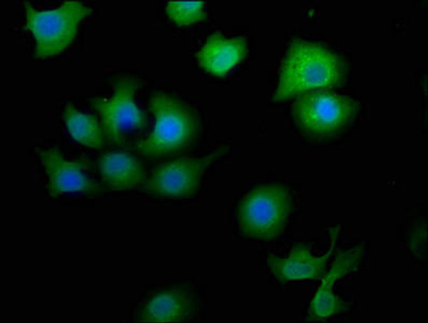 MTMR9 Antibody (PACO63847)