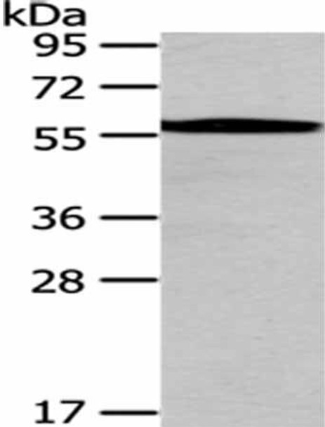 CHEK1 Antibody (PACO17692)