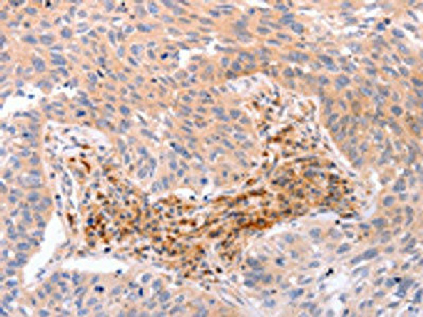 NR3C1 Antibody (PACO18012)