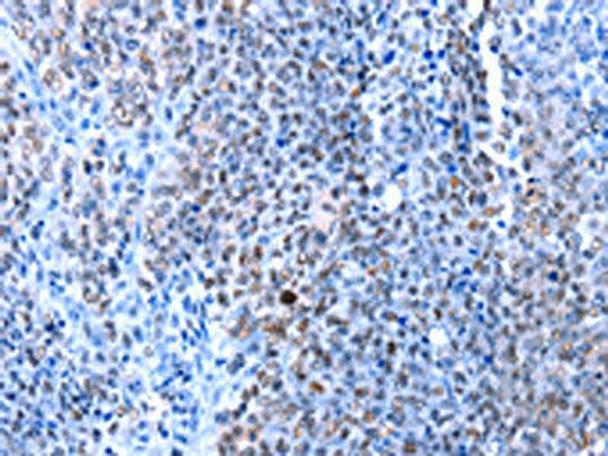 HMGB1 Antibody (PACO18068)