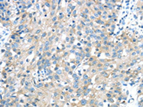 IGFBP3 Antibody (PACO18092)