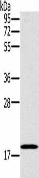 STMN1 Antibody (PACO18140)