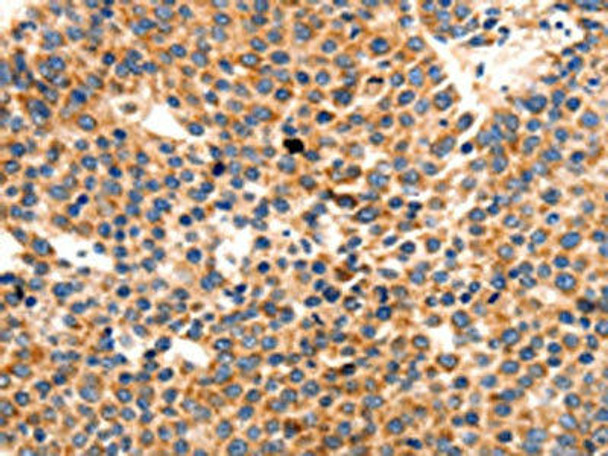 PAFAH1B1 Antibody (PACO18154)