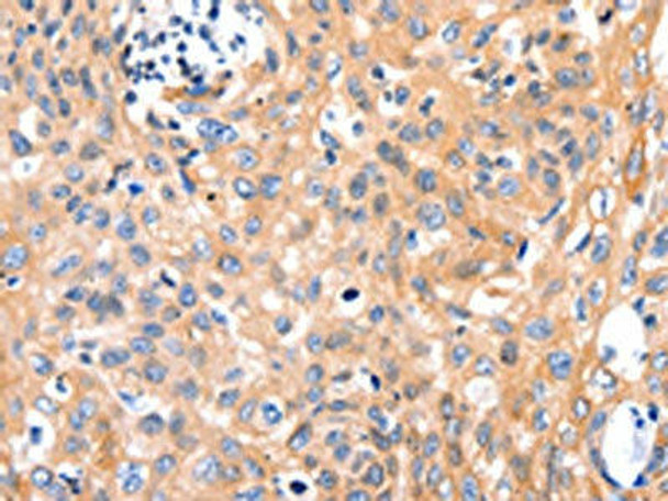 MYL9 Antibody (PACO18258)