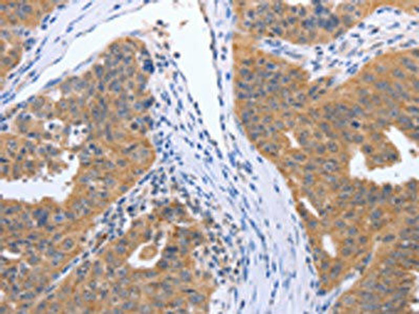 GEMIN2 Antibody (PACO18395)