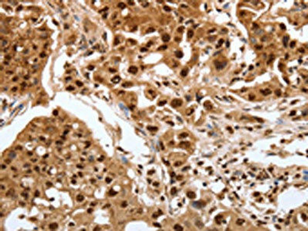 SRF Antibody (PACO18434)