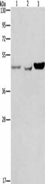 ACP2 Antibody (PACO18511)