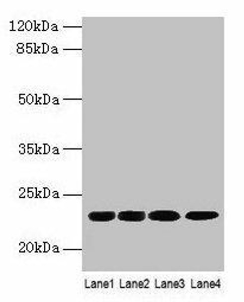CBX5 Antibody (PACO25528)