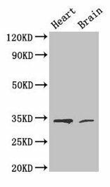CDK5 Antibody (PACO25680)