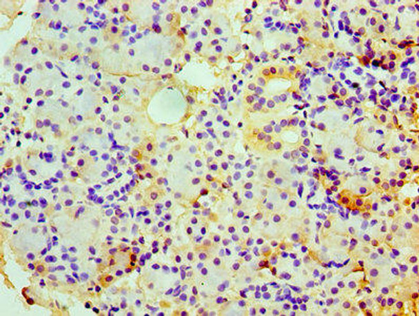 CHGA Antibody (PACO25737)