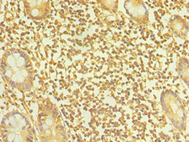 TAC1 Antibody (PACO43055)