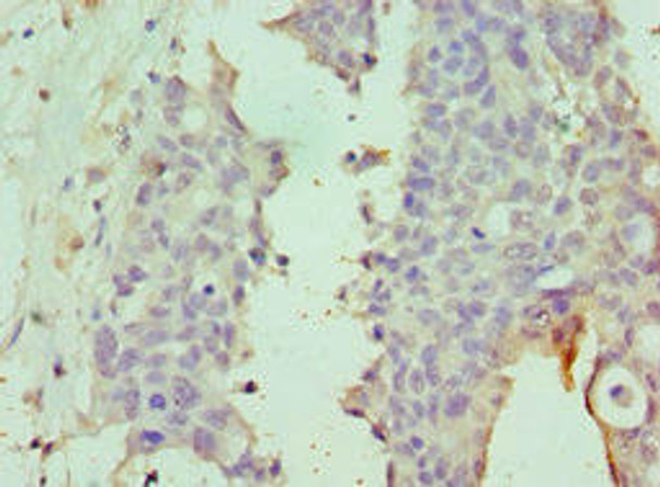 DPP8 Antibody (PACO43192)