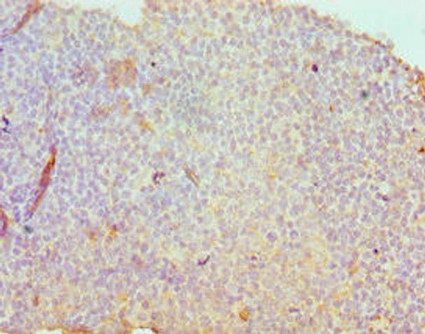 SDC1 Antibody (PACO43255)