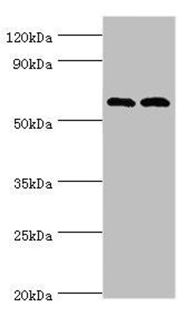 PAK2 Antibody (PACO43533)
