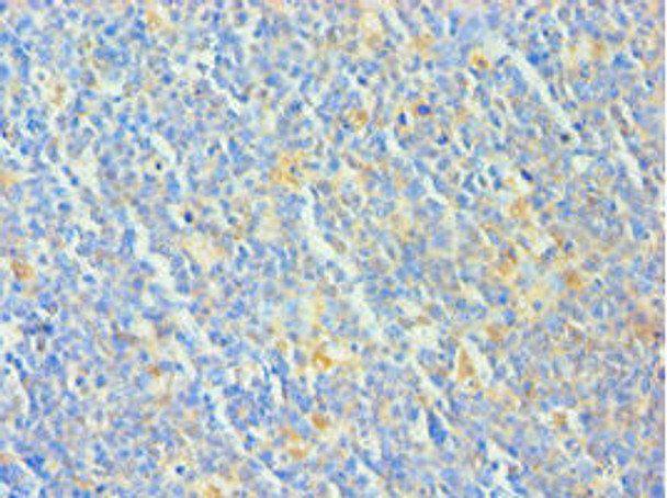 TCOF1 Antibody (PACO43572)