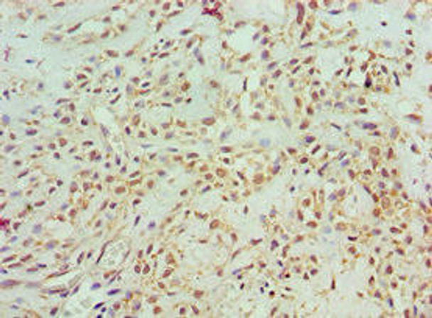 ASCC3 Antibody (PACO43579)