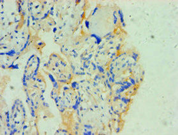 SOAT1 Antibody (PACO43586)