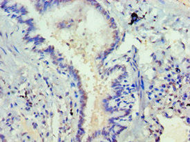 DVL2 Antibody (PACO43594)