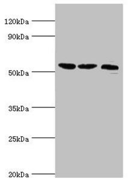 SMYD1 Antibody (PACO43618)