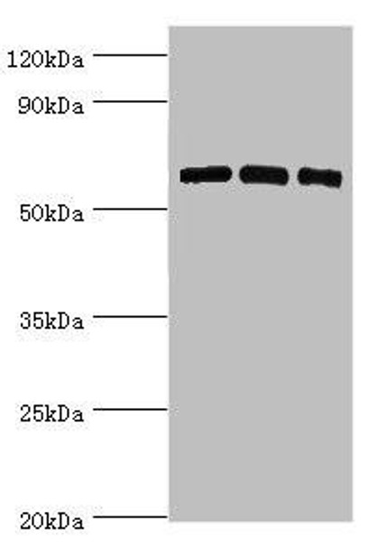 PRKAA2 Antibody (PACO43640)