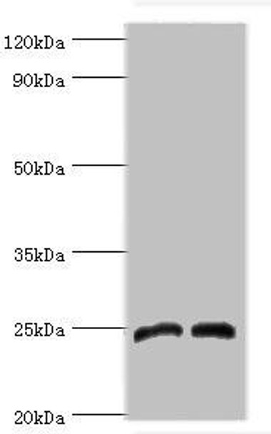 DKK4 Antibody (PACO43660)