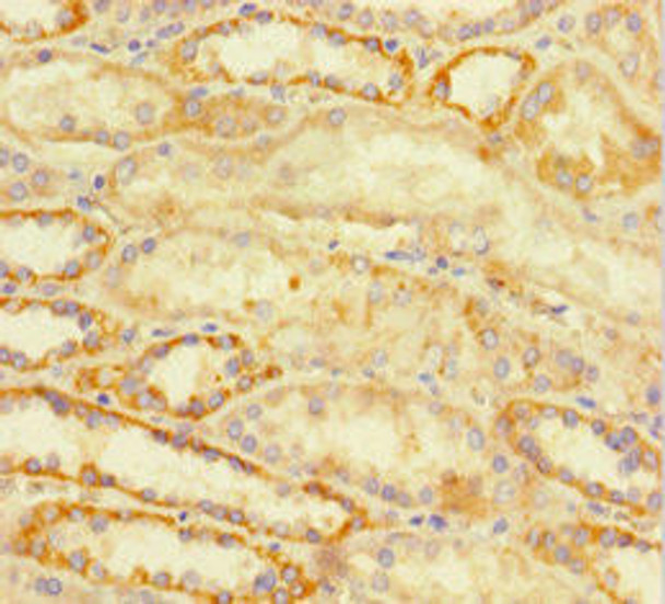 ATRX Antibody (PACO45690)